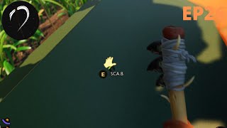 Grounded Ep 26 More ScaB Bracelets