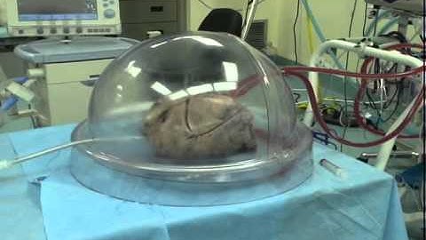 Toronto EX VIVO Lung Perfusion System