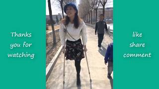 Amputee leg : Happy life with only one leg #12