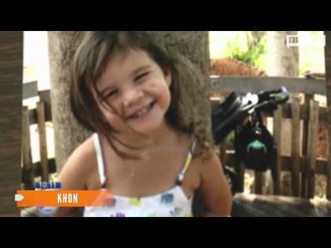 3-year-old California girl dies during dental procedure