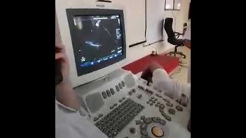 [Thực hành] Hướng dẫn siêu âm tim