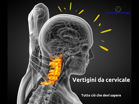 Video: Qual è L'effetto Della Manipolazione Spinale Sulla Soglia Del Dolore Da Pressione Nei Soggetti Giovani E Asintomatici? Uno Studio Randomizzato Controllato Con Placebo, Con Un