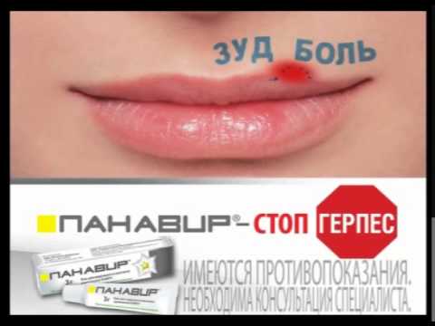 Панавир гель