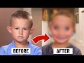 Why are these kids getting plastic surgeries