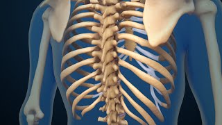 Back Surgery | Spinal Fusion | Nucleus Health