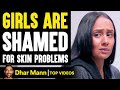 Girls Are SHAMED For SKIN PROBLEMS, They Instantly Regret It | Dhar Mann