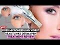 Microneedling at homebeautlinks professional microneedling derma penmicroneedling before and after