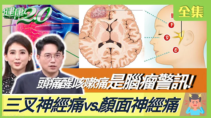 手腳無力是中風？頭痛到醒、咳嗽更痛竟是腦瘤警訊！如雷擊頭痛3穴位止痛！ 健康2.0 20230409【完整版】江坤俊 韋汝 丁賢偉 戴承正 洪素卿 沈瑞斌 雷議宗 @tvbshealth20 - 天天要聞