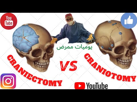 يوميات ممرض - عمليات الدماغ - Craniectomy vs Craniotomy -part 1