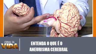 De pequenos de tratamento vasos cerebrais doença isquêmica