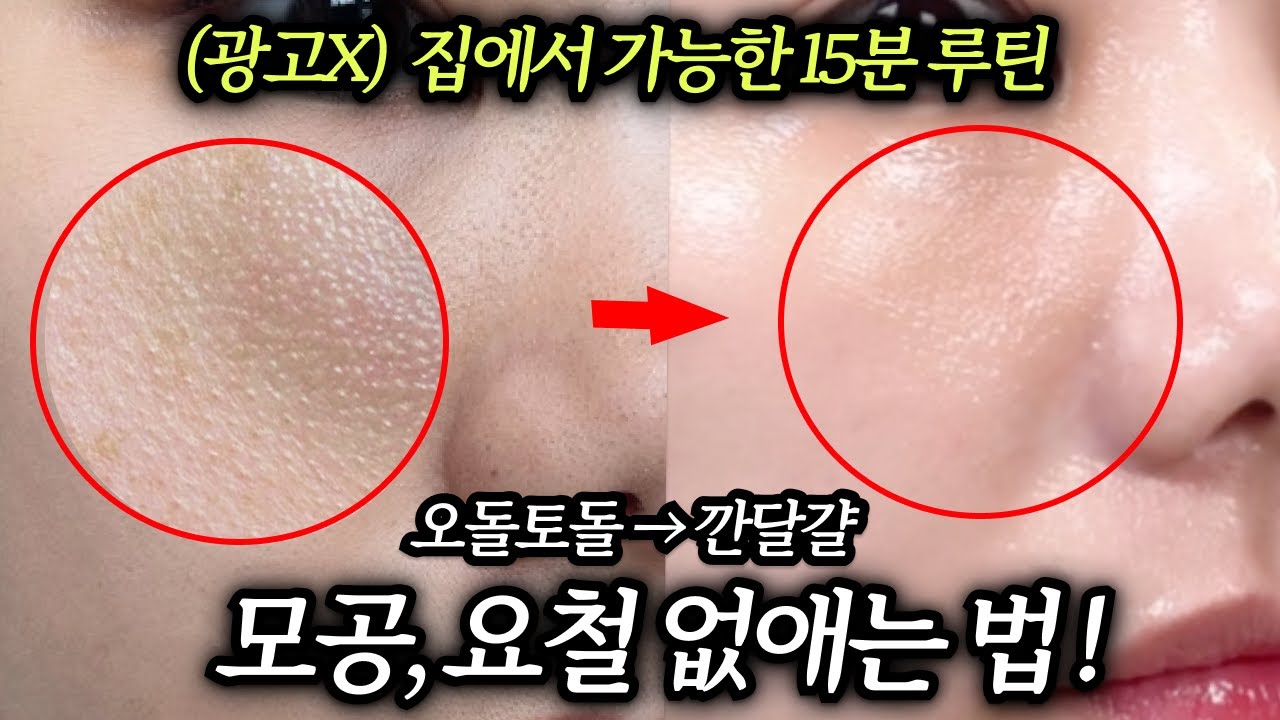 아무도 알려주지 않는 현실적인 모공,요철 없애는법 ! 집에서 깐달걀 가능!! (제품, 루틴 싹다 공개)
