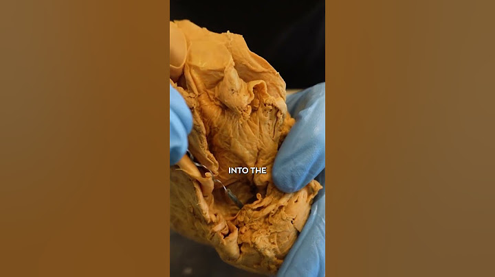 Crazy Things Found In Dead Bodies