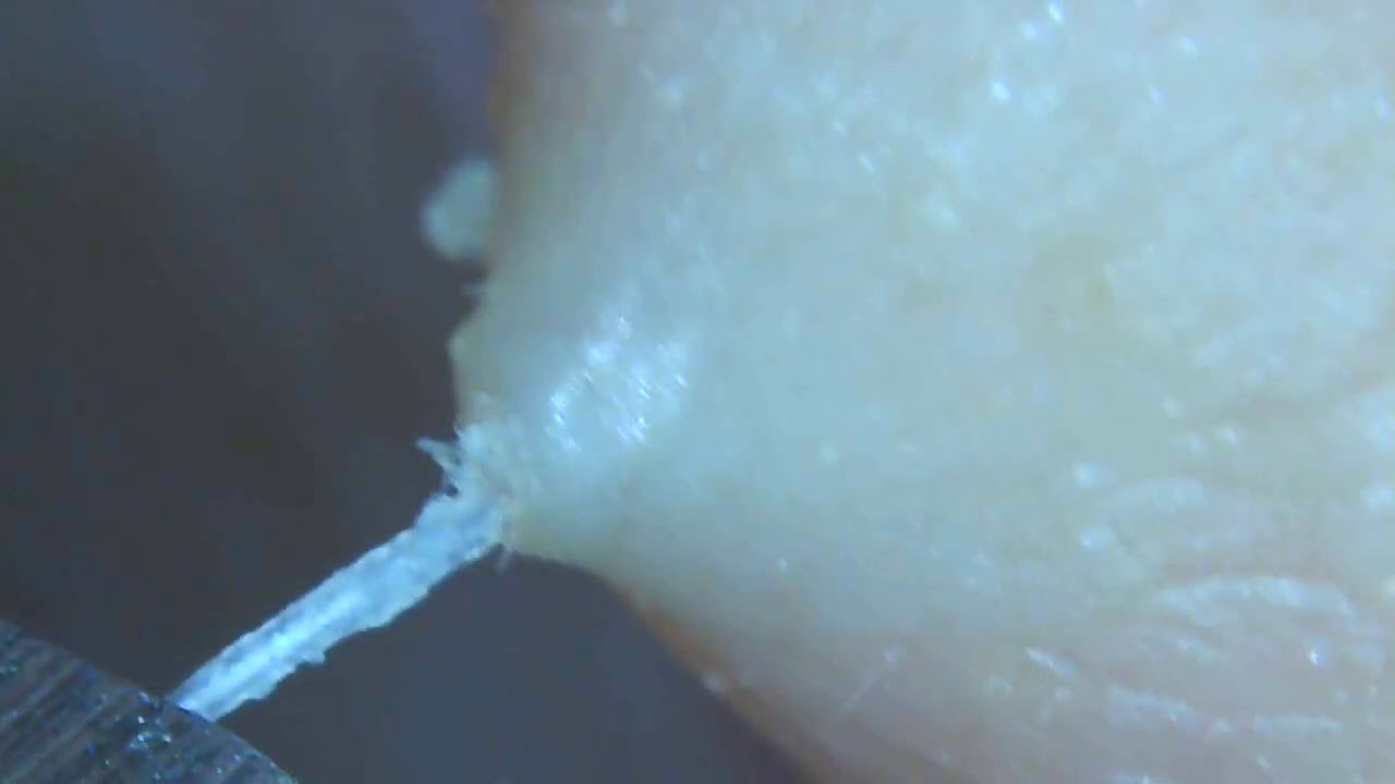 pull out white beard deliberately. Zoom up. YouTube