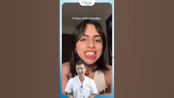 Răng Hô, Răng Khấp Khểnh Có Niềng Invisalign Được Không ? | Bác Sĩ Yên