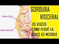 Os Perigos da Barriguinha de Chopp ( Gordura VIsceral ) e como acabar com essa barriga .