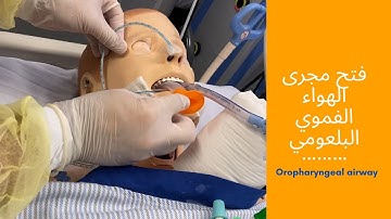oropharyngeal airway    فتح مجرى الهواء الفموي البلعومي