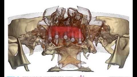 Flexible Direct Multi-Volume Rendering in Interactive Scenes (5)