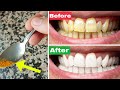 تبييض الاسنان بالكركم في دقيقة👍طريقة تبييض الاسنان طبيعيا👌wasafat tabyid asnan al asnan