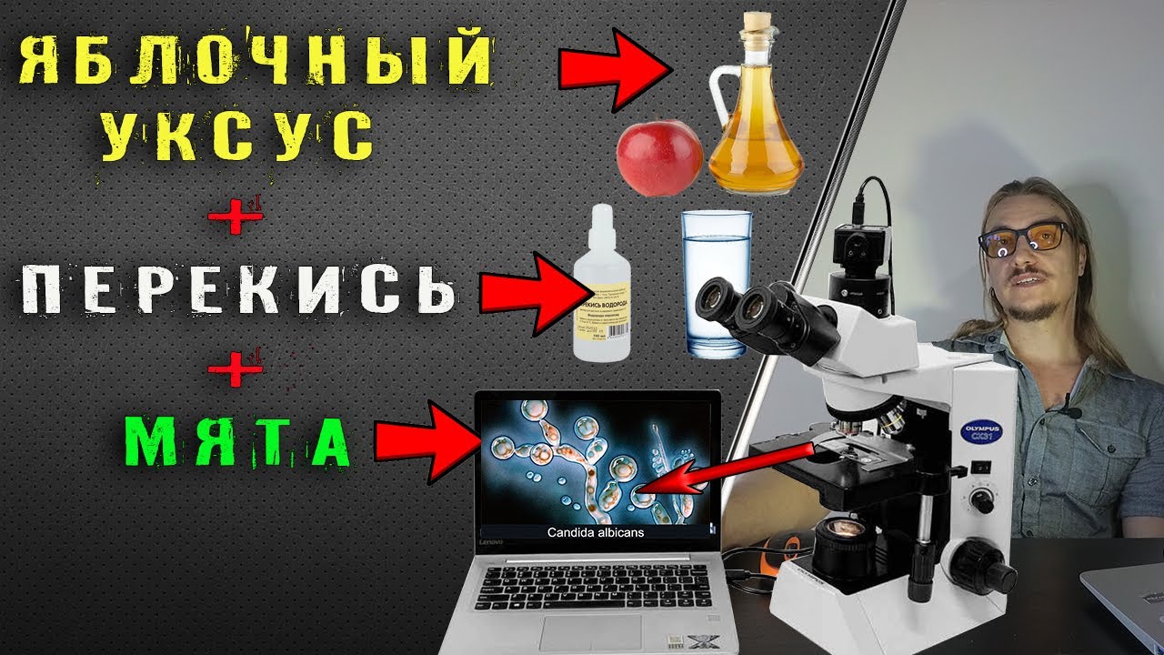 Как Перекись прополис мята и Яблочный уксус подавляют грибок в ...