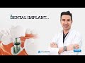 Dental implant اسعار زراعة الأسنان و كل ما تبحثون عن زراعة الأسنان 2021 Alfa Dental .istanbul.Turkey