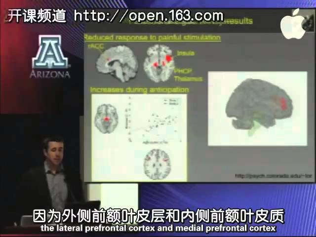 0005 亚利桑那大学公开课:精神病学病例研讨 安慰剂镇痛法:探究人脑情感调节机制的窗口 网易公开课+
