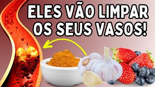 SINTOMAS DE ARTÉRIA ENTUPIDA: 6 ALIMENTOS INFALÍVEIS PARA LIMPÁ-LAS| Dr Dayan Siebra