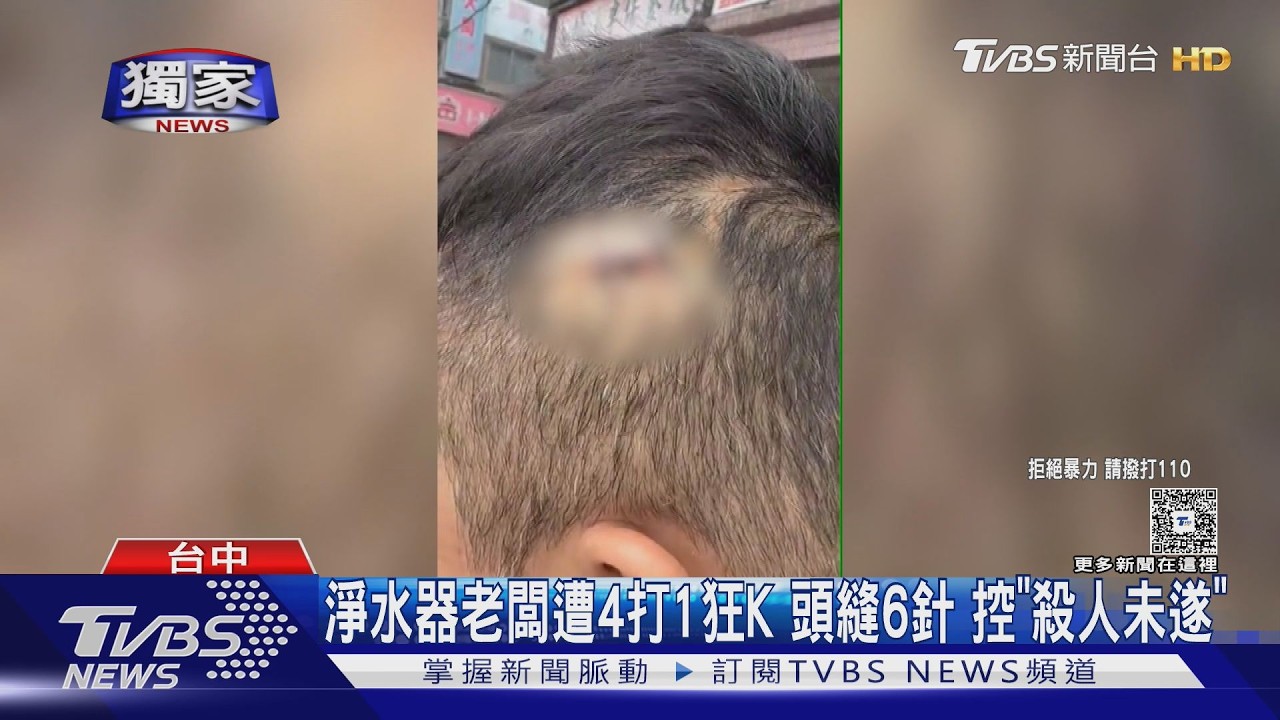 #獨家 淨水器老闆遭4打1狂K 頭縫6針 控「殺人未遂」｜TVBS新聞 @TVBSNEWS01