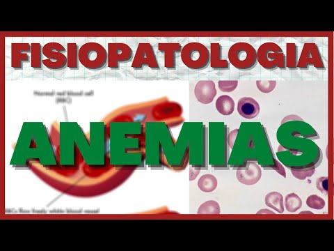 Video: ¿La hemorragia causa anemia?