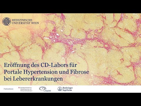 Fibrose bei Hepathitis-C-Patienten