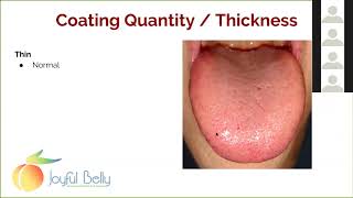 Art of Ayurveda Tongue Diagnosis 3 of 9: Tongue Coating Information