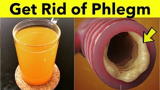 How to Get Rid of Phlegm in Throat - Natural Home Remedy for Phlegm in Throat