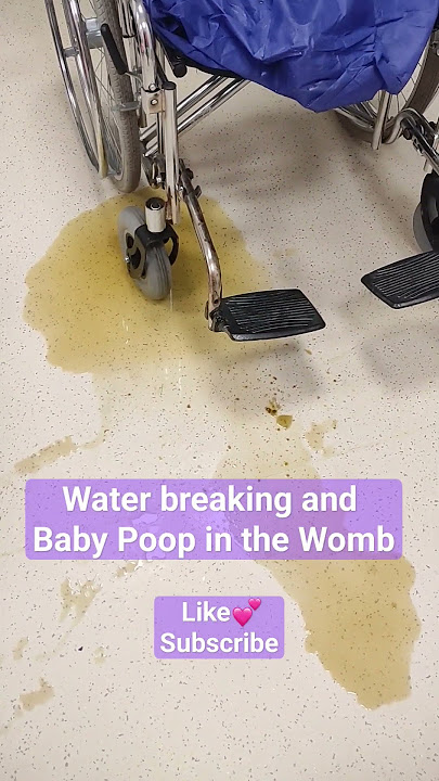 Water breaking and Baby Poop in the Womb🦧✨ #shorts
