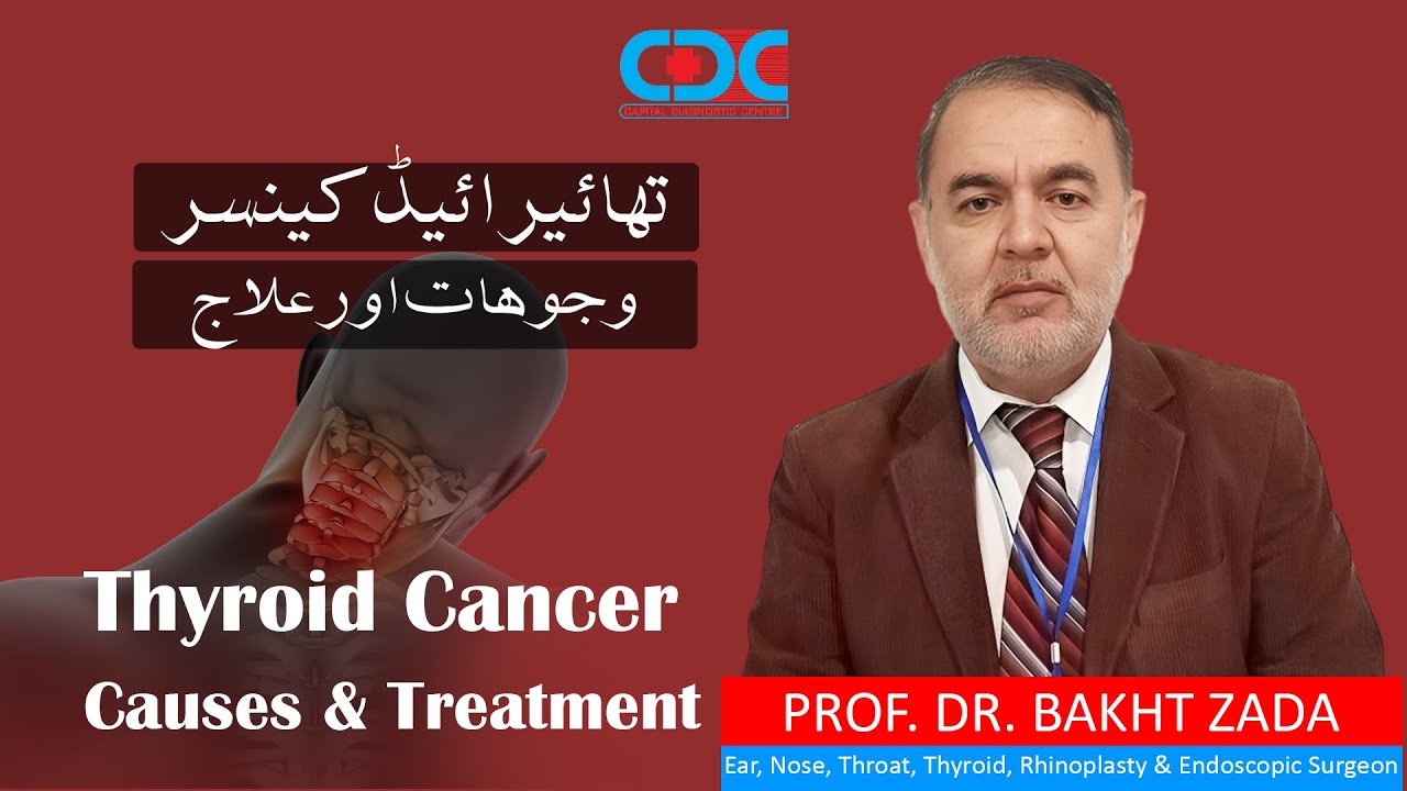 Prof. Dr. Bakht Zada on Thyroid Cancer Awareness - YouTube