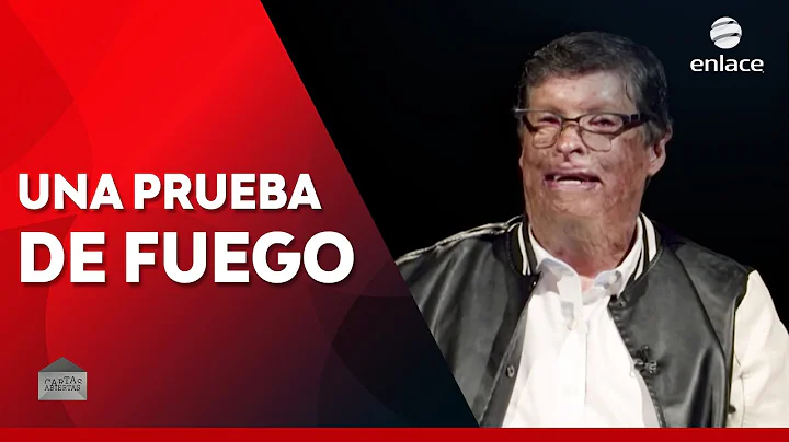 Irwin Snchez - Una prueba de fuego - Cartas Abiert...
