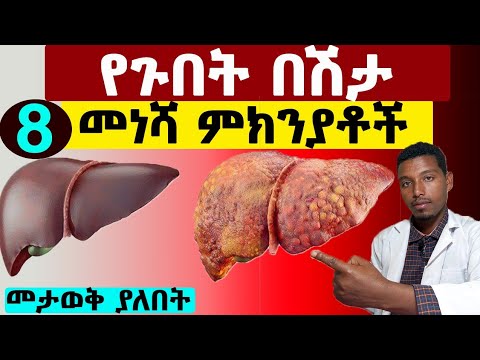 ቪዲዮ: የመጠባበቂያ መብራት መቀየሪያ ምንድነው?