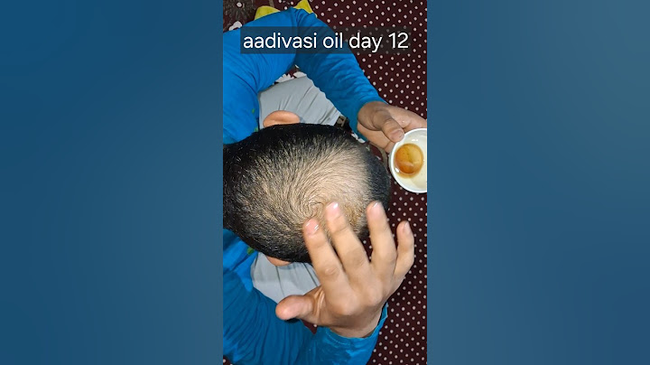 real adivasi oil || adivasi oil before and after || adivasi oil benefits in hindi #aadivasi #hair