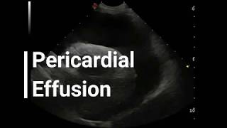 Vet Emergency Ultrasound: Draining a Pericardial Effusion