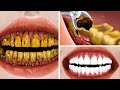 Asmr the best treatment for yellowed teeth carious teeth for male boxers     