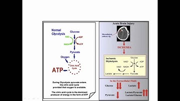 Cerebral Microdialysis
