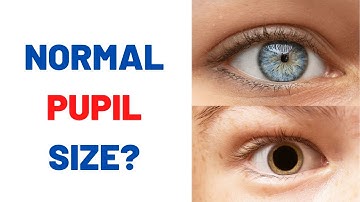 Are your pupils normal size?