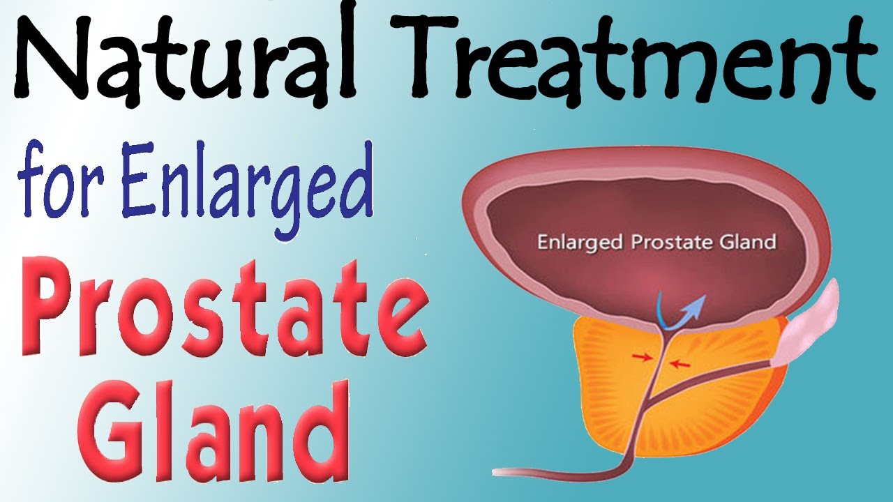 Best Treatment For Enlarged Prostate Home Remedies That Can Shrink