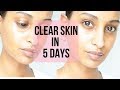 CLEAR GLOWING SKIN w/ Sweet Almond Oil| Segen Misghina