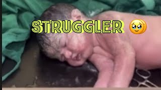 baby struggler ?shorts babylover subscribemychannel newbornbaby newbornbabyshorts 1million