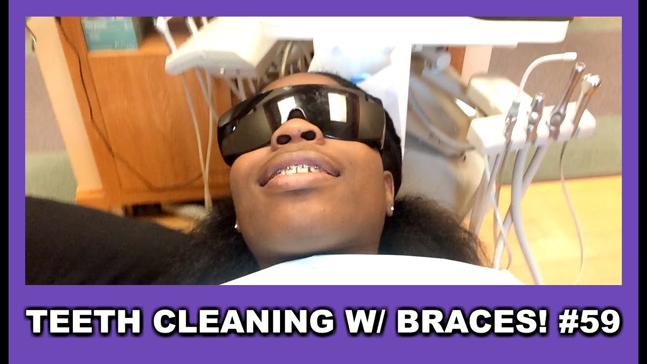TEETH CLEANING WITH BRACES! 59 YouTube