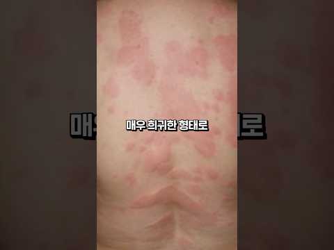 휴대폰을 쓸 수 없는 <strong>희귀병</strong>