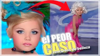 El PEOR CASO de los CONCURSOS de BELLEZA