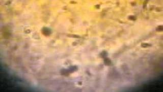 sperms movie 20091121(007).3gp