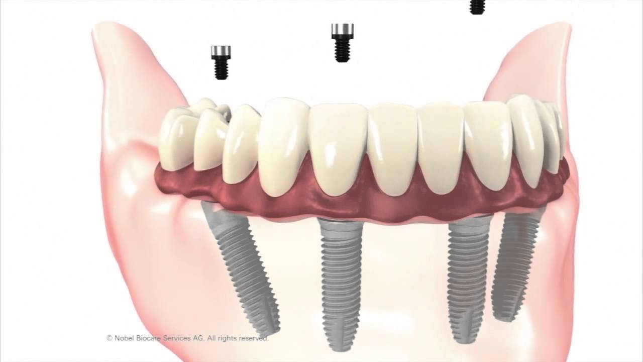 Dr. Henninger You to North County Cosmetic and Implant