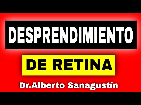 DESPRENDIMIENTO DE RETINA 💥  síntomas, diagnóstico y tratamiento