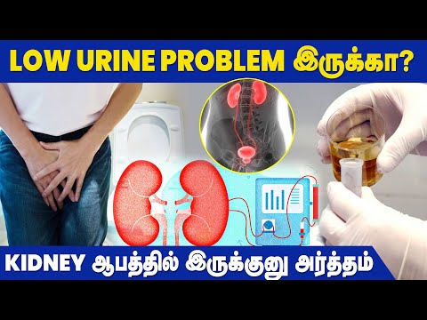 Low Urine Output - Causes, Symptoms and Preventive Measures